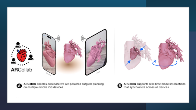 ARCollab enables doctors to interact with patient-specific 3D heart models